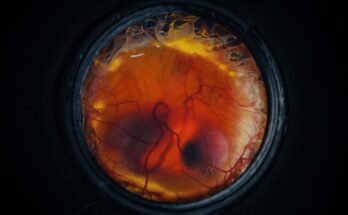 a chicken embryo, with visible eyes and beak, surrounded by blood vessels and inside a black metal container.
