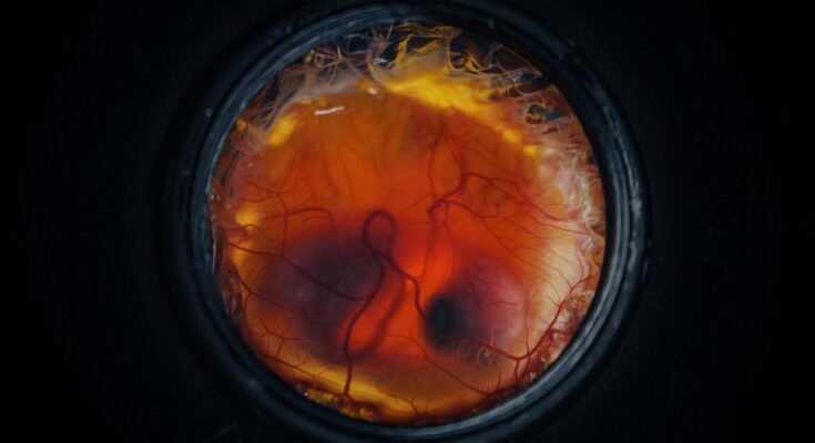 a chicken embryo, with visible eyes and beak, surrounded by blood vessels and inside a black metal container.