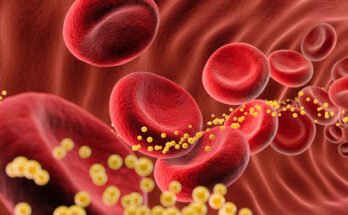 A cartoon of blood cells with cholesterol flowing through a blood vessel.